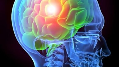 Top 10 Facts About Rehabilitation in Traumatic Brain Injury In 2023